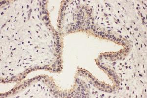 Image no. 1 for anti-RAB8A, Member RAS Oncogene Family (RAB8A) (AA 170-183), (C-Term) antibody (ABIN3042554)