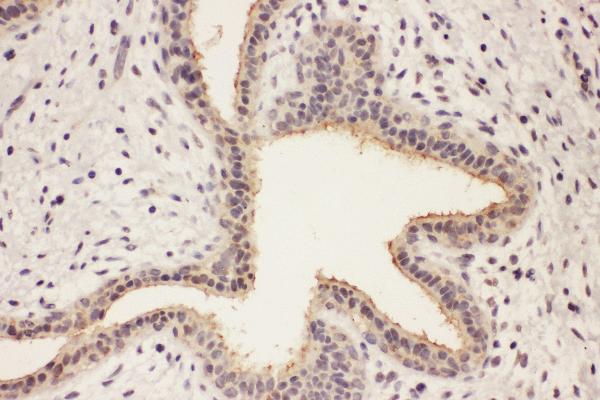 anti-RAB8A, Member RAS Oncogene Family (RAB8A) (AA 170-183), (C-Term) antibody