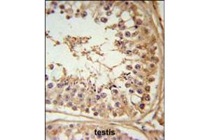 Image no. 2 for anti-F-Box and Leucine-Rich Repeat Protein 5 (FBXL5) (AA 86-115), (N-Term) antibody (ABIN5534266)
