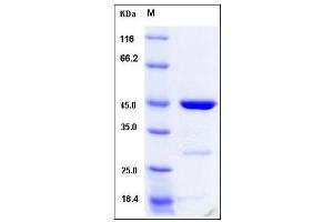 Image no. 1 for Cyclin-Dependent Kinase Inhibitor 2D (p19, Inhibits CDK4) (CDKN2D) (Active) protein (GST tag) (ABIN2215334)