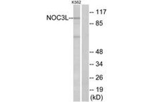 Image no. 1 for anti-Nucleolar Complex Associated 3 Homolog (NOC3L) (AA 415-464) antibody (ABIN1535128)