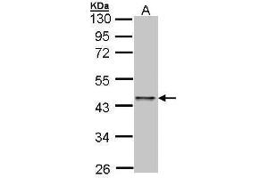 Image no. 2 for anti-E2F Transcription Factor 1 (E2F1) (Center) antibody (ABIN2854981)