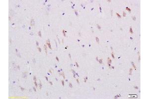 SEMA4C antibody  (AA 751-833)