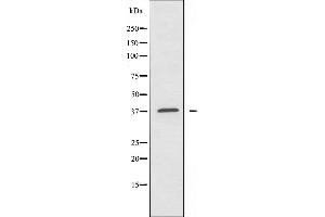 Image no. 1 for anti-RNA Binding Motif Protein 39 (RBM39) antibody (ABIN6257458)