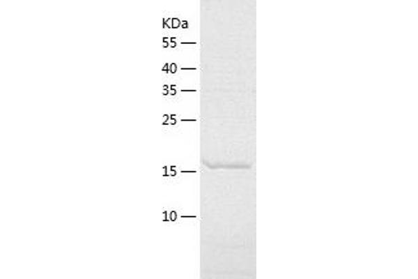PTP4A2 Protein (AA 2-167) (His tag)