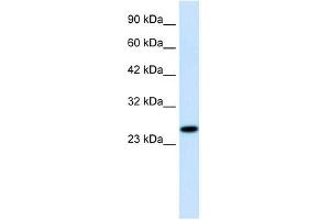 Image no. 2 for anti-Regulator of G-Protein Signaling 13 (RGS13) (Middle Region) antibody (ABIN629717)