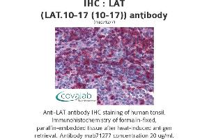 Image no. 1 for anti-Linker For Activation of T Cells (LAT) antibody (ABIN1724096)