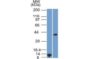 Image no. 1 for anti-Arginase, Liver (ARG1) (AA 11-97) antibody (ABIN6939857)
