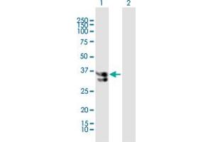 Western Blot analysis of KATNA1 expression in transfected 293T cell line by KATNA1 MaxPab polyclonal antibody.