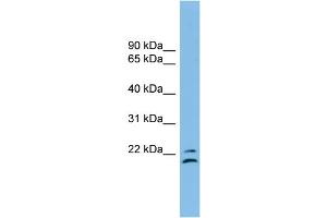 Image no. 2 for anti-Tetraspanin 1 (TSPAN1) (Middle Region) antibody (ABIN2781305)
