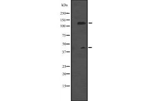 Image no. 2 for anti-Minichromosome Maintenance Deficient 9 (MCM9) antibody (ABIN6257825)