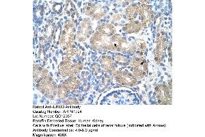 Image no. 2 for anti-Uroporphyrinogen Decarboxylase (UROD) (N-Term) antibody (ABIN2773790)