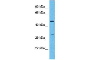 anti-Pancreatic Lipase-Related Protein 2 (PNLIPRP2) (C-Term) antibody