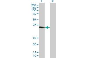 Image no. 2 for anti-Potassium Channel Tetramerisation Domain Containing 7 (KCTD7) (AA 1-289) antibody (ABIN531077)