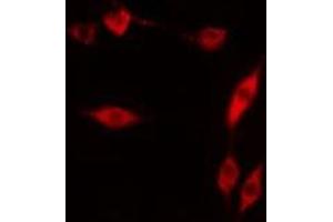 Image no. 4 for anti-Apurinic/Apyrimidinic Endonuclease 1 (APEX1) (N-Term) antibody (ABIN6259977)