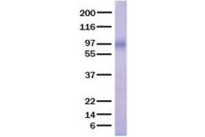 Image no. 1 for Angiopoietin-Like 3 (ANGPTL3) (Active) protein (His tag) (ABIN2714690)