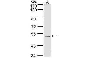Image no. 1 for anti-Forkhead Box D1 (FOXD1) (C-Term) antibody (ABIN2854683)