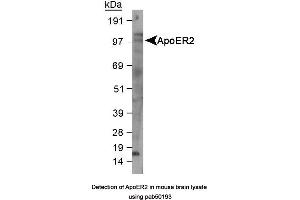Image no. 1 for anti-Low Density Lipoprotein Receptor-Related Protein 8, Apolipoprotein E Receptor (LRP8) (AA 863-963), (C-Term) antibody (ABIN363502)