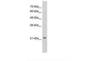 Image no. 3 for anti-Distal-Less Homeobox Protein 2 (DLX2) (AA 238-287) antibody (ABIN203372)