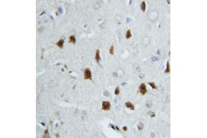 Image no. 4 for anti-Heat Shock 70kDa Protein 8 (HSPA8) (AA 13-31), (N-Term) antibody (ABIN3044300)