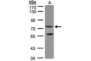 PDE4C antibody  (Center)