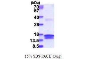 Image no. 1 for Uridine-Cytidine Kinase 1 (UCK1) (AA 143-273) protein (His tag) (ABIN5853718)