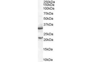 Image no. 4 for anti-Suppressor of Cytokine Signaling 1 (SOCS1) (C-Term) antibody (ABIN184575)