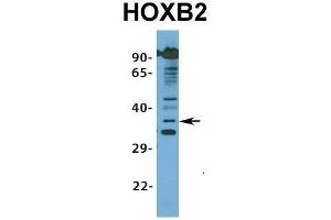 Image no. 5 for anti-Homeobox B2 (HOXB2) (N-Term) antibody (ABIN2776384)