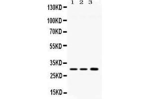 Image no. 1 for anti-Aquaporin 11 (AQP11) (AA 35-70), (N-Term) antibody (ABIN4886472)