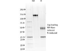 Image no. 8 for anti-Cadherin-16 (CDH16) antibody (ABIN6939019)