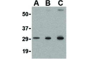 Image no. 3 for anti-TP53 induced glycolysis regulatory phosphatase (TIGAR) (Internal Region) antibody (ABIN6655743)