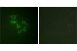 Immunofluorescence analysis of HeLa cells, using PIP5K (Phospho-Ser307) Antibody.
