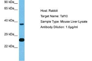 anti-TAF10 RNA Polymerase II, TATA Box Binding Protein (TBP)-Associated Factor, 30kDa (TAF10) (C-Term) antibody