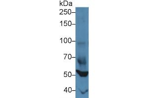 Image no. 1 for anti-Forkhead Box P1 (FOXP1) (AA 122-346) antibody (ABIN5013569)