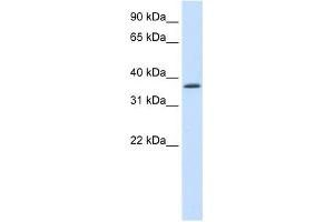 Image no. 1 for anti-SAP30 Binding Protein (SAP30BP) (C-Term) antibody (ABIN925913)