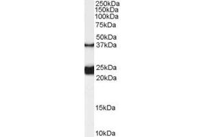 Image no. 1 for anti-Galanin Receptor 1 (GALR1) (Internal Region) antibody (ABIN190891)