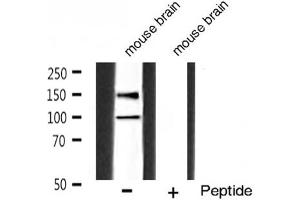 Image no. 3 for anti-Insulin-Like Growth Factor 1 Receptor (IGF1R) (pTyr1165), (pTyr1166) antibody (ABIN6255780)