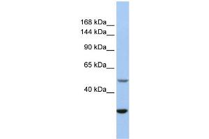 Image no. 1 for anti-Zinc Finger, ZZ-Type Containing 3 (ZZZ3) (Middle Region) antibody (ABIN2773970)