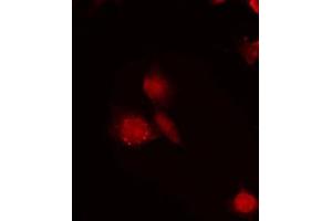 Image no. 1 for anti-RNA Binding Motif Protein 6 (RBM6) antibody (ABIN6261260)