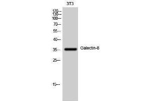 Image no. 1 for anti-Lectin, Galactoside-Binding, Soluble, 8 (LGALS8) (Internal Region) antibody (ABIN3184733)