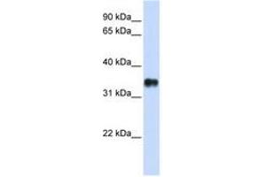 Image no. 1 for anti-Potassium Channel Tetramerisation Domain Containing 7 (KCTD7) (N-Term) antibody (ABIN6740422)