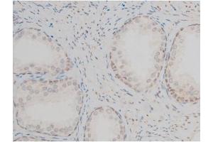 Image no. 2 for anti-GATA Binding Protein 1 (Globin Transcription Factor 1) (GATA1) (pSer142) antibody (ABIN6254982)