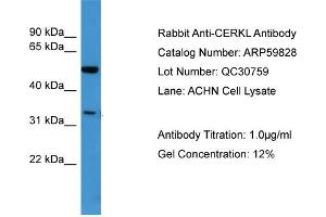 Image no. 2 for anti-Ceramide Kinase-Like (CERKL) (N-Term) antibody (ABIN2788233)