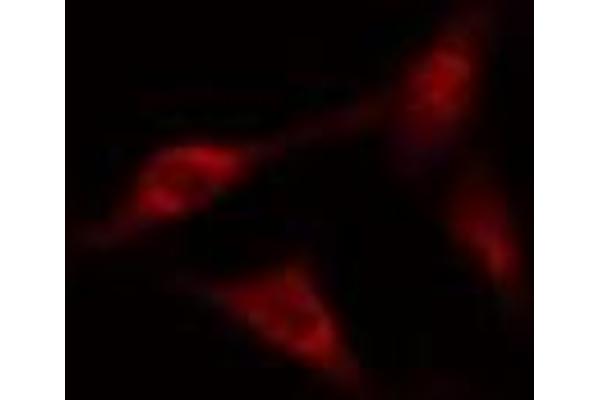 anti-Heat Shock 70kDa Protein 9 (Mortalin) (HSPA9) antibody