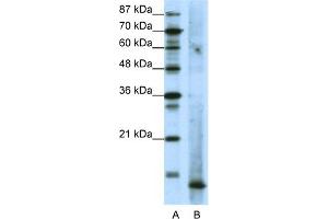 Image no. 1 for anti-MDS1 and EVI1 Complex Locus (MECOM) (N-Term) antibody (ABIN2780631)