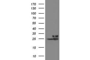 Image no. 5 for anti-Prefoldin Subunit 3 (PFDN3) antibody (ABIN1501707)