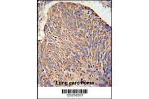 Immunohistochemistry (IHC) image for anti-Coiled-Coil Domain Containing 130 (CCDC130) antibody (ABIN2158072)