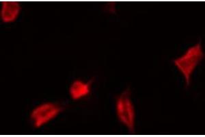 Image no. 2 for anti-Yes-Associated Protein 1 (YAP1) (pSer127) antibody (ABIN6256124)