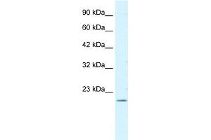 Image no. 1 for anti-Forkhead Box P2 (FOXP2) (N-Term) antibody (ABIN2778104)