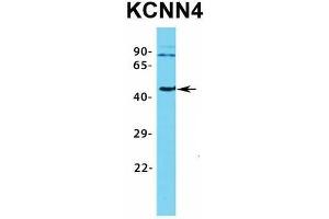 Image no. 4 for anti-Potassium Intermediate/small Conductance Calcium-Activated Channel, Subfamily N, Member 4 (KCNN4) (C-Term) antibody (ABIN2776147)